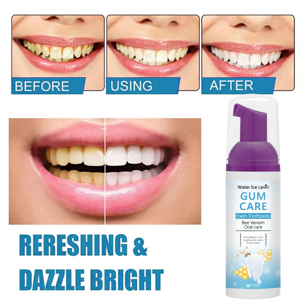 Water Ice Levin Gum Care Schau – Teeth Whitening Xylitol Gum Bewertung und Preis