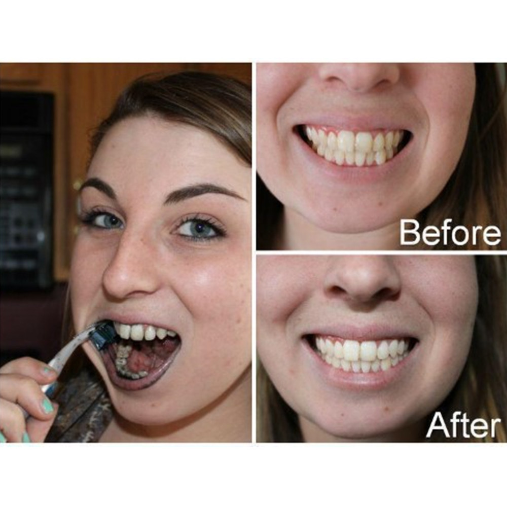 Bambus Holzkohle Zähne Zahn De – Teeth Whitening Price Bewertung und Preis