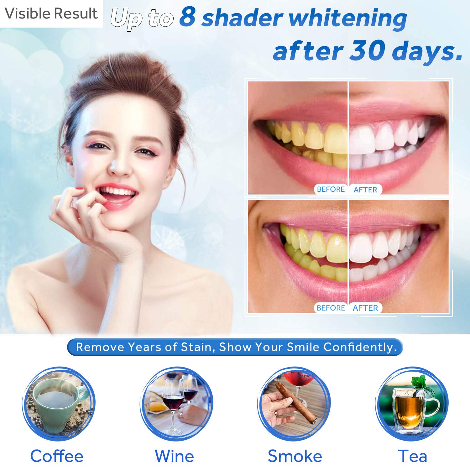 Zahnaufhellungsgel, Nachfüllsp – Teeth Whitening Laser Bewertung und Preis