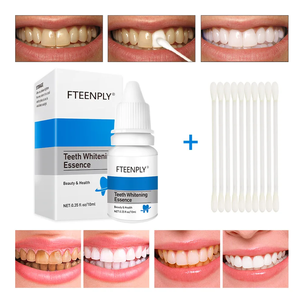 FTEENPLY Zahnaufhellung Essenz – Teeth Whitening Price Bewertung und Preis